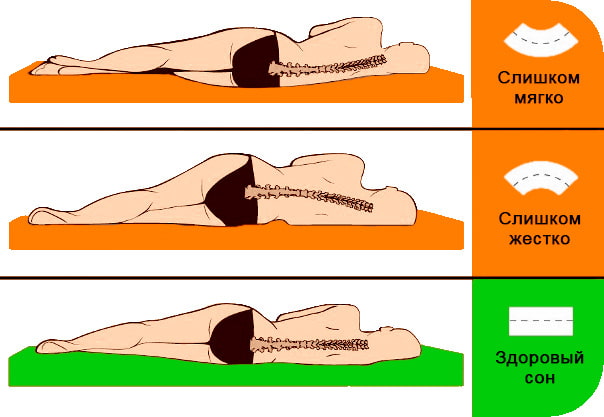Az ortopéd matracok merevsége